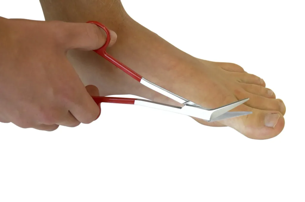 Toenail scissors, ergonomic