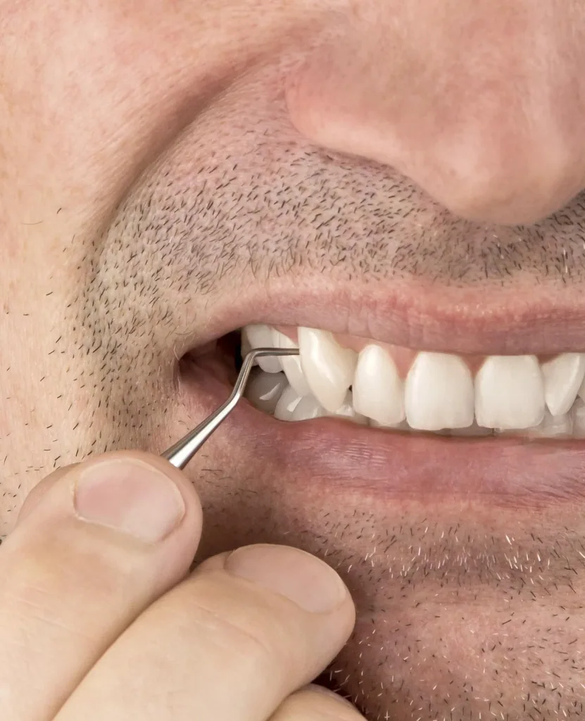 Tooth cleaner "Dental to go"