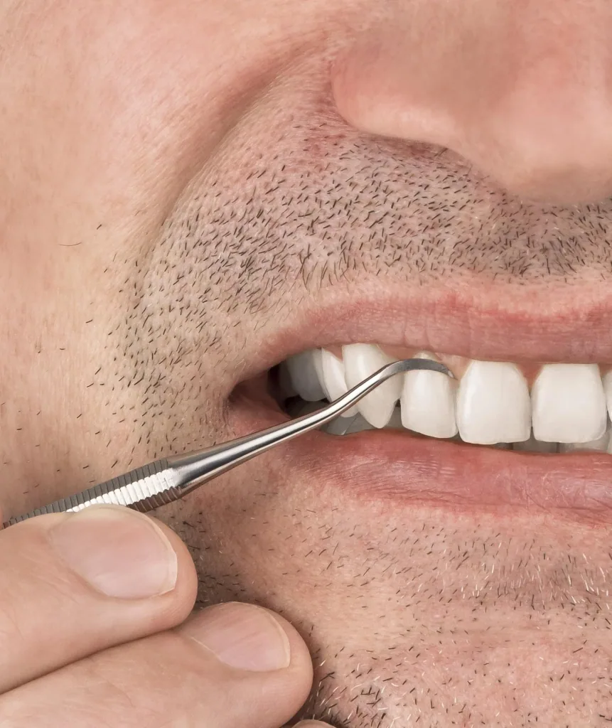 Tooth cleaner "Dental to go"