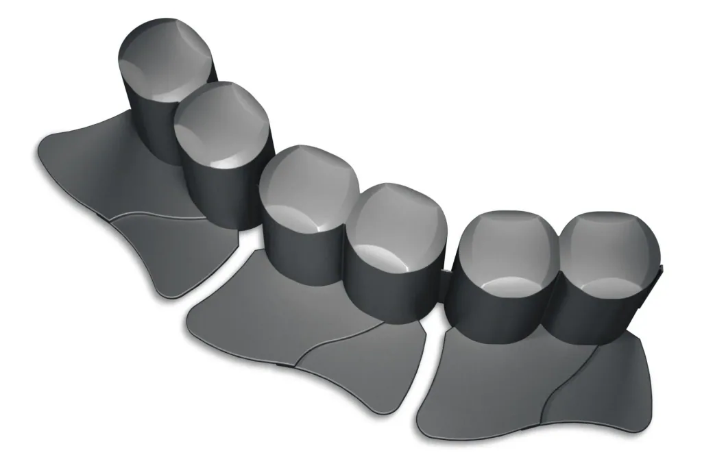 Bed edging PALISADE, grey - 8 pieces - 3.02 m