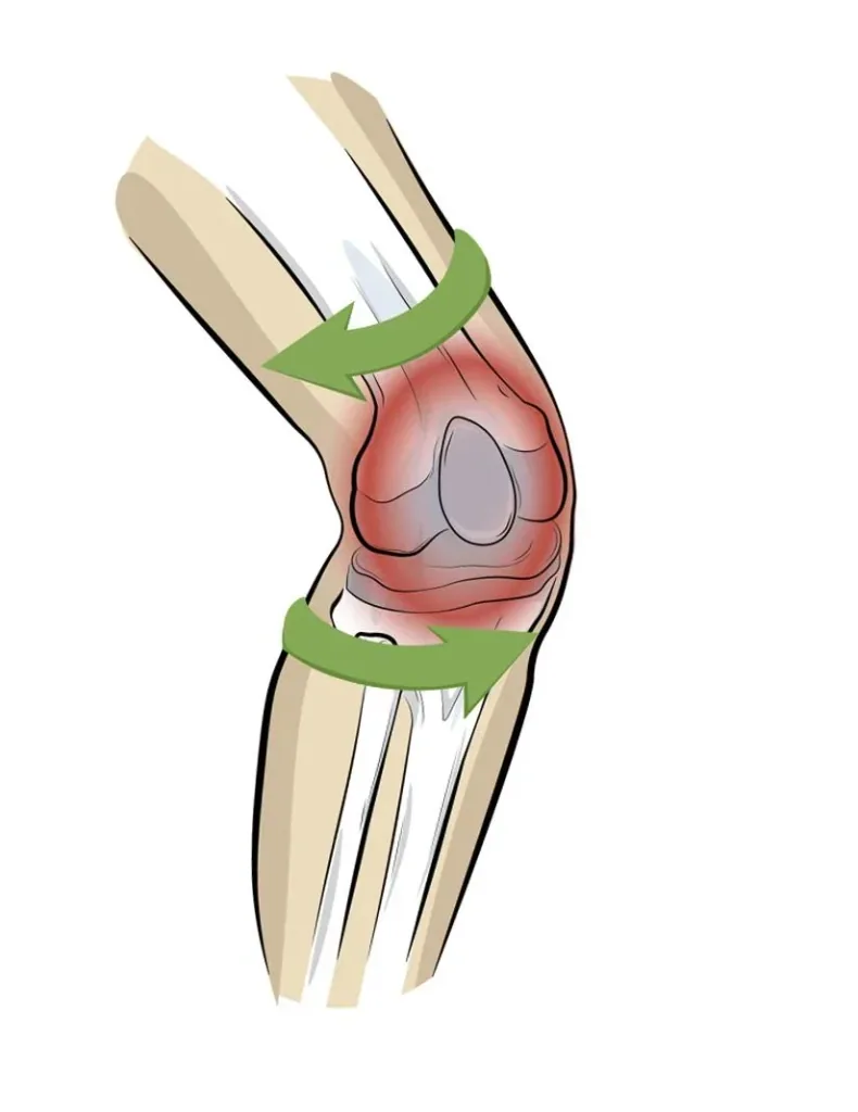 PatellaTec knee support, size XXL