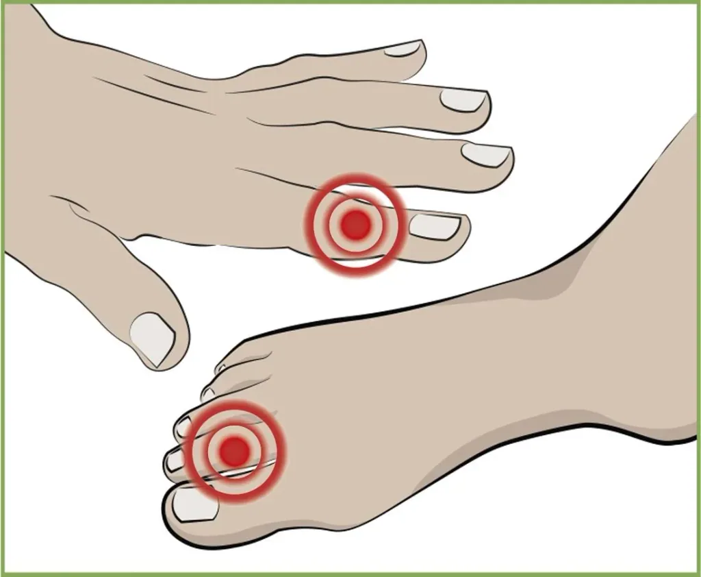 Finger and toe protectors, 2 each