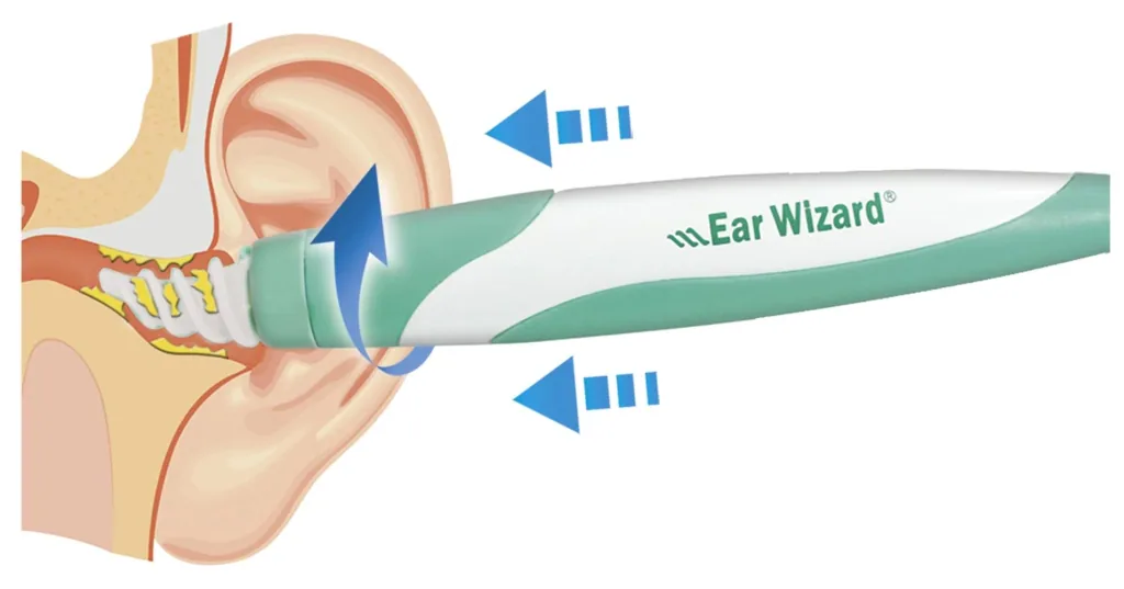 Ear Wizard ear cleaner set, with 15 silicone tips and storage box, 17 pieces