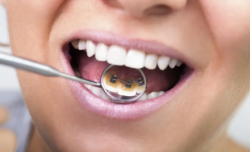 Dental care set