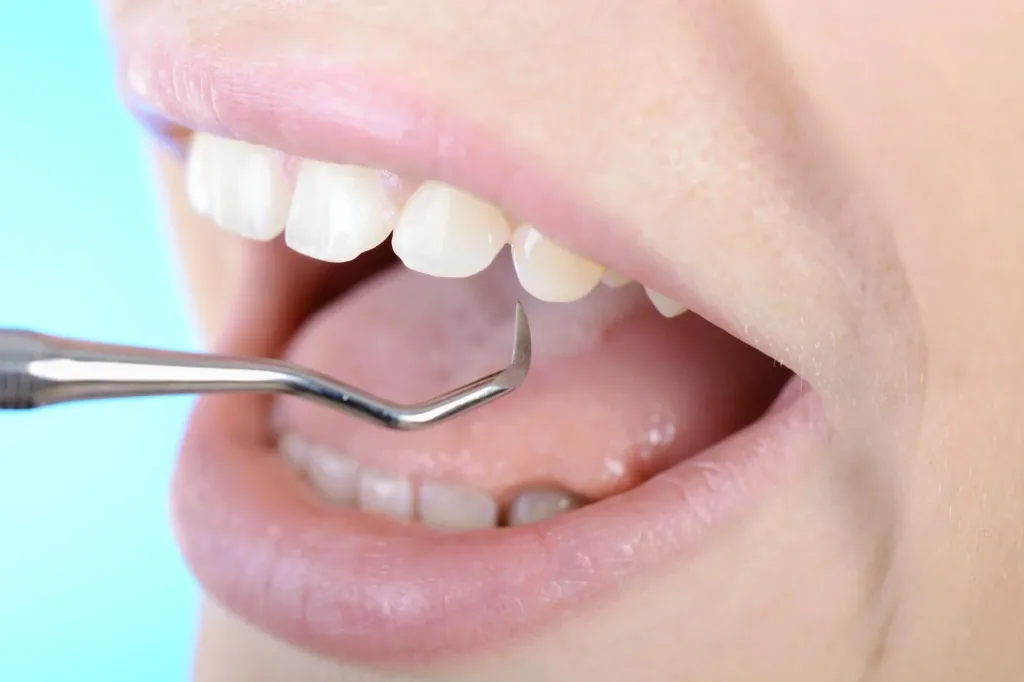Dental care set