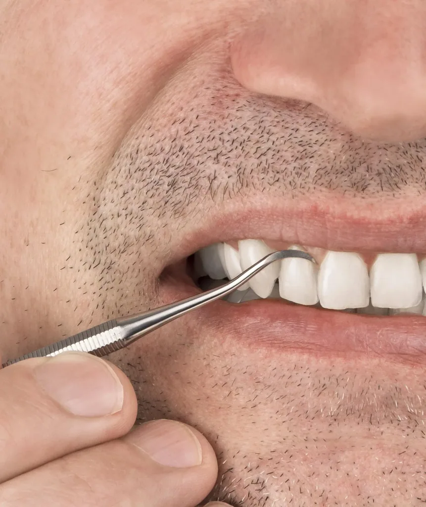 Dental care set