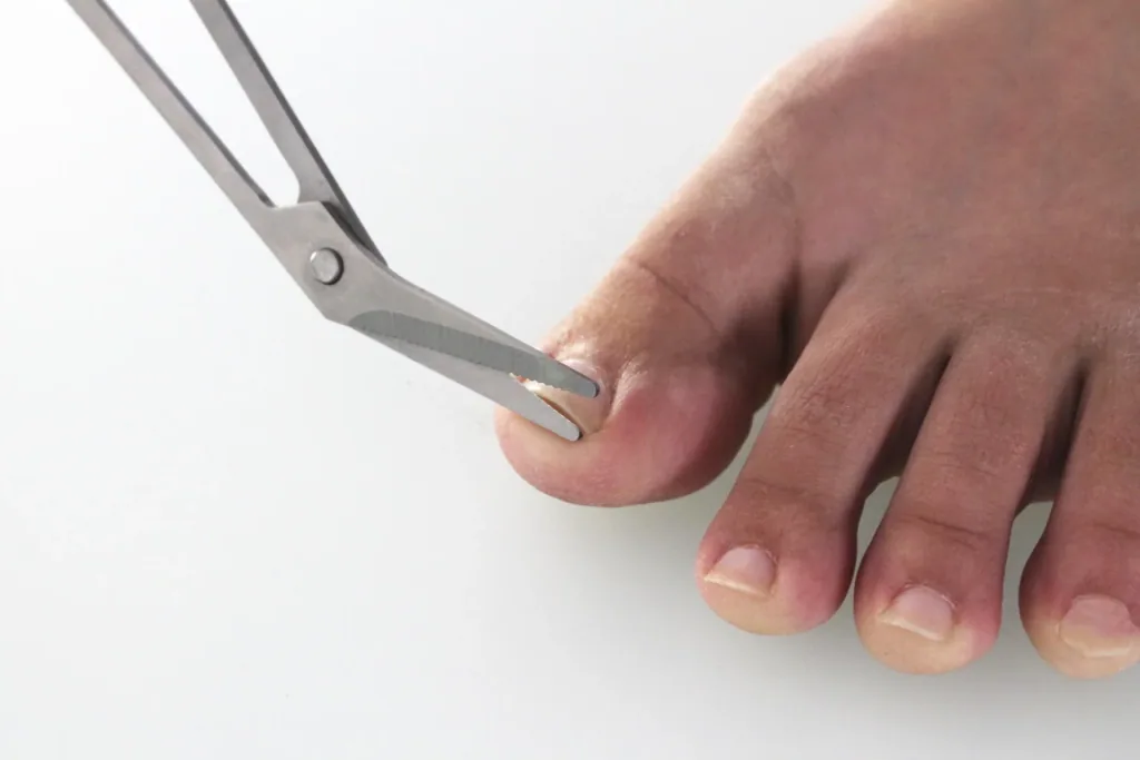 Pedicure scissors